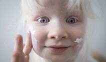 4 yaşındaki Defne’nin hikayesi! 13 Haziran’da Albino hakları ve bilinçlenme günü