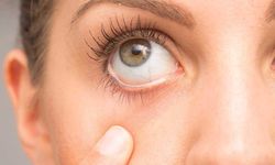 Göz kuruluğu tedavisi: Görmenin konforlu yolu