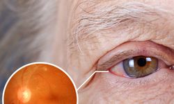 Dr. Bilgin: "Diyabetik retinopati körlük ile sonuçlanabilen ciddi bir göz hastalığıdır"
