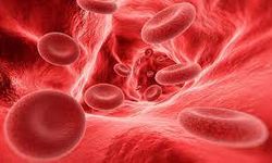 Hemofili: Kan pıhtılaşması bozukluğu