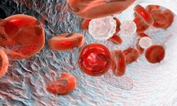 Genetik kökenli kan hastalığı: Akdeniz Anemisi nedir?