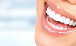 Doğal yollarla dişleri beyazlatmanın formülleri: Sağlıklı gülüş için pratik ipuçları