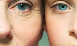 Hızlı yaşlanma: Nedenleri, belirtileri ve önlemler