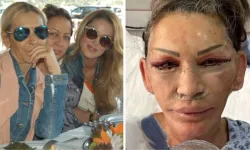 Petek Dinçöz'ün annesi yüz gerdirme ameliyatı oldu! Yeni hali kızını solladı