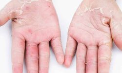Uzmanlar uyarıyor: Deterjan kullanımı ellere zarar verebilir!