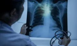 Akciğer kanseri bakın ne tetikliyormuş? Uzmanlar uyarıyor