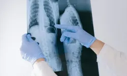 90 dakika içinde hayatını kaybetti! 34 yaşındaki kadın BT taraması sonrası hayatını kaybetti
