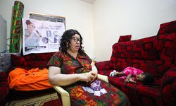 Afrika’da Albinizmli bireylerin mücadelesi: Ayrımcılıktan Sanata…