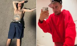 Justin Bieber’a vasilik davasında son gelişme: Hayranlarını endişelendiren haller