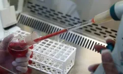 Bulaşıcı hastalıklar tarihe karışıyor! 2030’da hayata geçecek kan devrimi