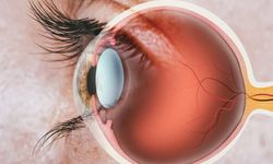 Retina ve vitreus hastalıkları erken fark edilmezse ne olur? Vitrektomi nedir ve hangi durumlarda uygulanır?