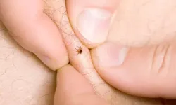 Kene ısırması neden tehlikeli? Hangi hastalıkları taşıyor? 10 gün kuralına dikkat!