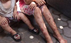 Suçiçeği alarmı! İki haftada 9 binden fazla vaka tespit edildi