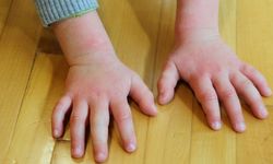 Yaz aylarında bebek sahibi olanlar dikkat! Güneş kremi seçerken bu hatayı sakın yapmayın: Alerjiye yol açabilir