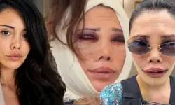 Yüzündeki deformasyonlar nedeniyle 2. kez ameliyat olmuştu: Didem Ceran son halini paylaştı!