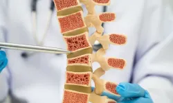 Osteoporoz neden sessiz ilerliyor? Uzmanı kemik kırığı riskine karşı uyardı