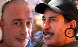 Kulak memesindeki çizgi kalp krizi habercisi mi? Uzmanlar gerçeği açıkladı