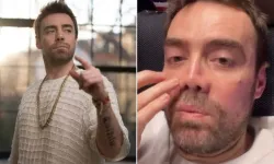 Murat Dalkılıç 13. ameliyatın ardından konuştu: “Bu noktaya gelmek bile bir mucize”