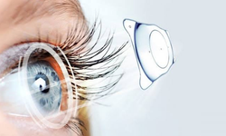 Akıllı lens ameliyatı kimlere uygulanır? Uzman isim merak edilenleri anlattı