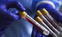 Ebola alarmı! İlk vaka doğrulandı, 44 kişi takibe alındı