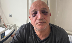 İzmir’de esnaf başkanına kanlı pusu!