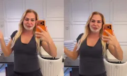 Nagihan Karadere yeniden estetik masasına yattı! İşte ilk görüntüsü