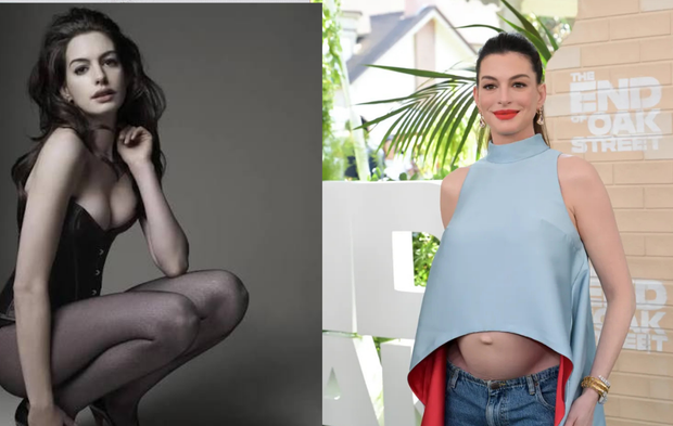 Karnı burnunda galalarda! Anne Hathaway kimdir, nereli? Evli mi? Hangi filmlerde oynadı? Instagram hesabı 2026