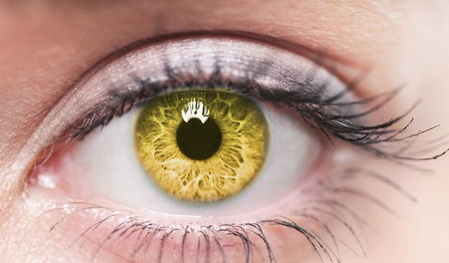 Yaşa bağlı sarı nokta hastalığı: Göz Sağlığı Tehlikesi