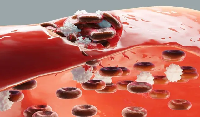 Hemofili: Kan pıhtılaşma bozukluğuyla mücadelede yeni gelişmeler