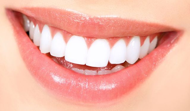 Parlak bir gülümseme için: Sarı ve lekeli dişleri beyazlatmanın 7 etkili yolu