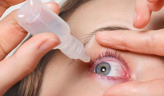 Göz kızarıklığını basit bir yorgunluk sanmayın! Uzmanı uyardı: Bu belirtilere dikkat