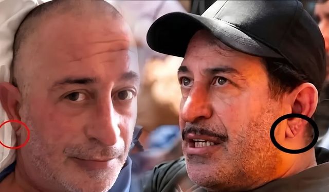 Kulak memesindeki çizgi kalp krizi habercisi mi? Uzmanlar gerçeği açıkladı