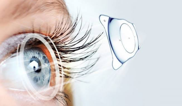 Akıllı lens ameliyatı kimlere uygulanır? Uzman isim merak edilenleri anlattı