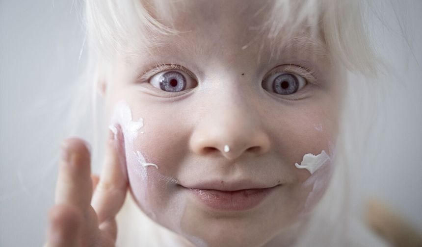 4 yaşındaki Defne’nin hikayesi! 13 Haziran’da Albino hakları ve bilinçlenme günü