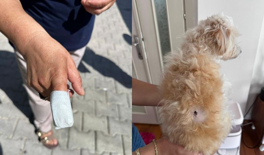 İzmir’de köpeğini kurtarmak isterken parmağı koptu!