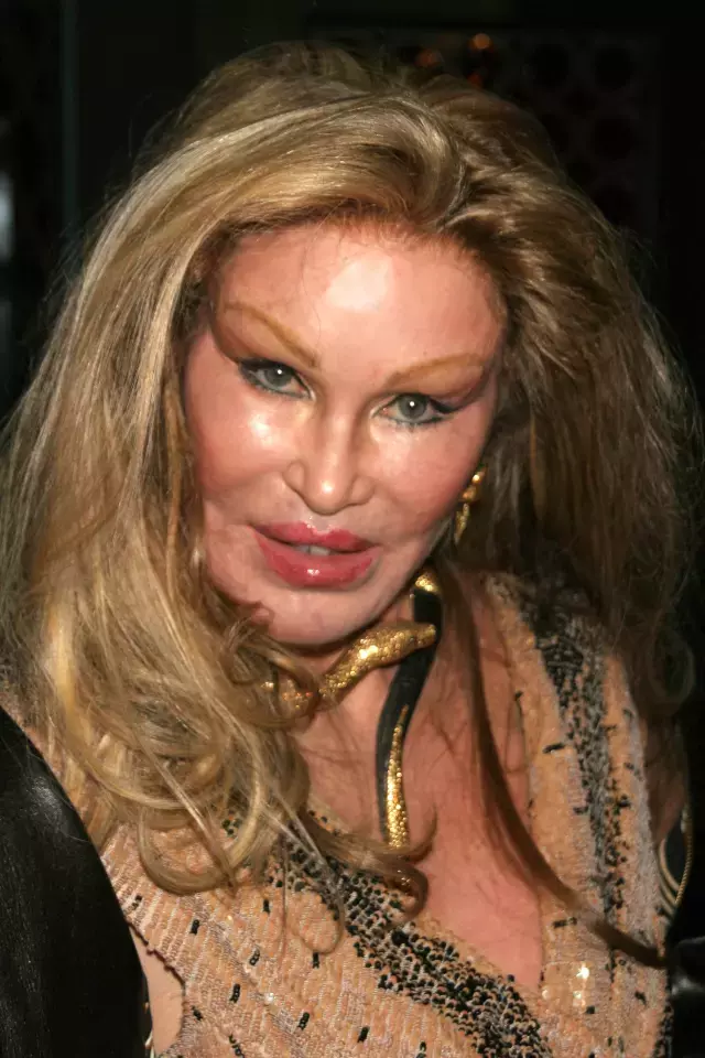 Kedi Kadin Lakapli Jocelyn Wildenstein Hayatini 18221086 4365 M