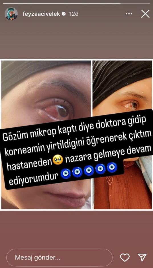 Feyzapng At5Rtm Z Vlk6 C U9 Z Z C95F Wg