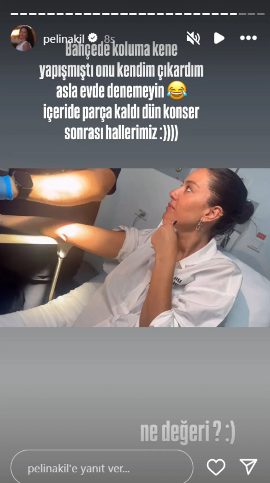 Pelin Akil 2-1