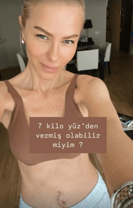 Unlu Sarkici Ameliyattan Sonra Ilk Kez Paylasim Yapti