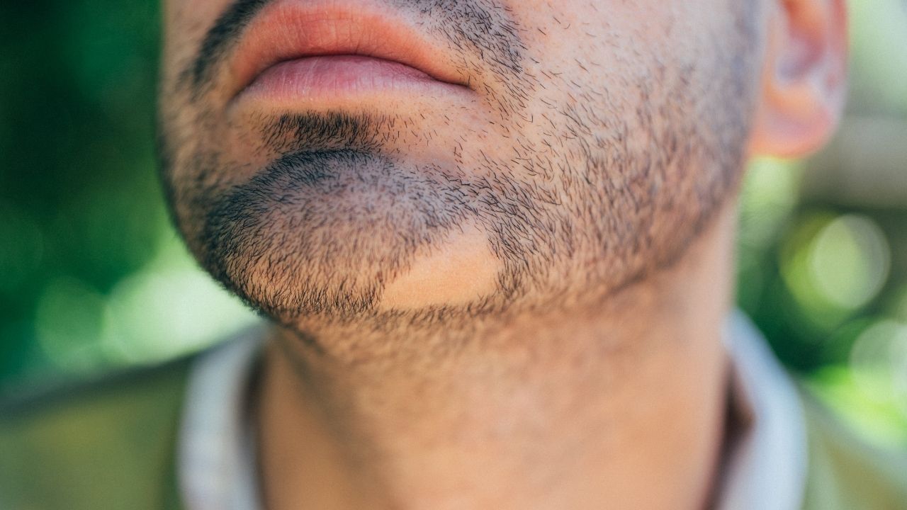 Sakalınızda Aniden Boşluklar Oluşuyorsa Dikkat! Dökülmesinin Arkasındaki Nedenler Sandığınız Gibi Olmayabilir (2)