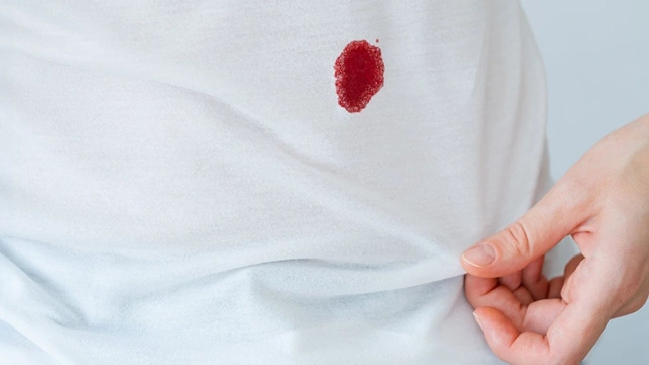 Kan Lekesi Nasıl Çıkar Kurumuş Kan Lekesini Çıkarmanın En Kolay Yolları (1)