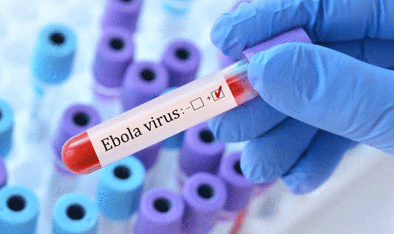 Ebola nedir, nasıl bulaşır? Belirtileri neler? İşte ebola virüsü hakkında bilinenler