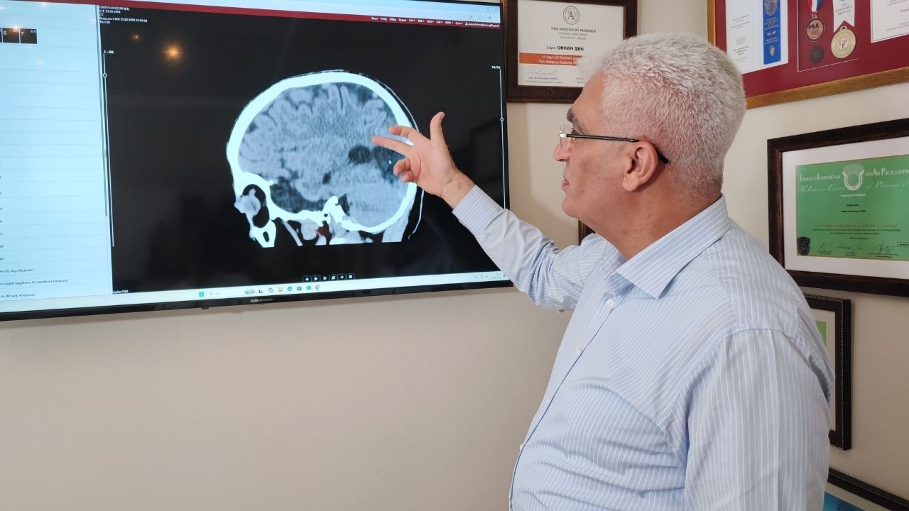 Meğer Belirtileri Kendini Gösteriyormuş! Uzmanı Inme Riskine Karşı Uyardı Hemen 112'Yi Arayın (2)